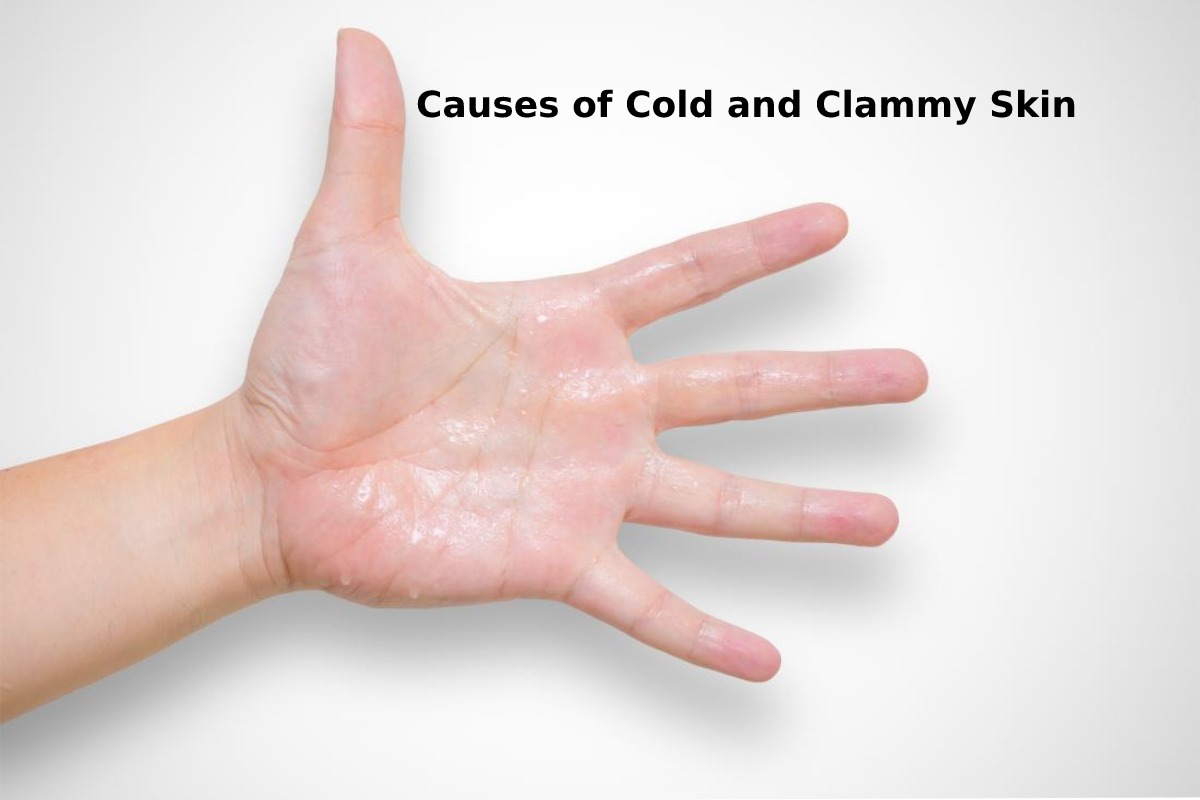 Causes Of Cold And Clammy Skin